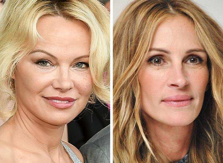 Hollywood’s most expensive plastic surgeries