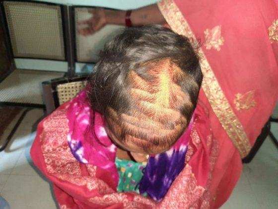 Bihar : प्रेमी की शादी से नाराज प्रेमिका ने दुल्हन के बाल काटे