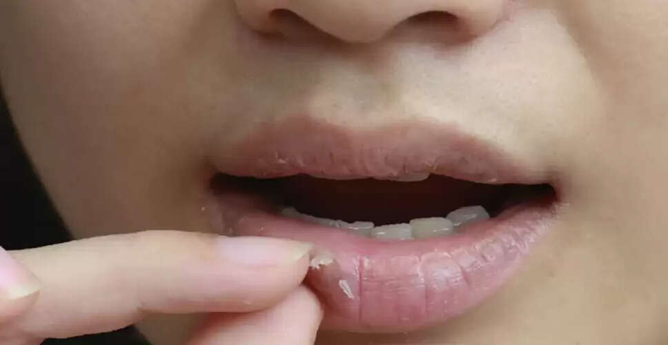 Essential Tips for Effective Lip Care: Keep Your Lips Soft and Pink