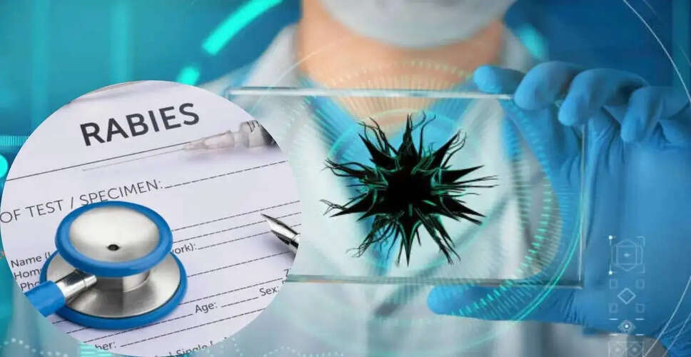 CDC Halts Diagnostic Testing for Rabies and Other Infectious Diseases