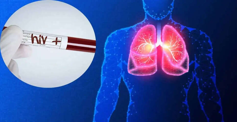 Historic HIV-Positive Lung Transplant Paves New Path for Organ Donation