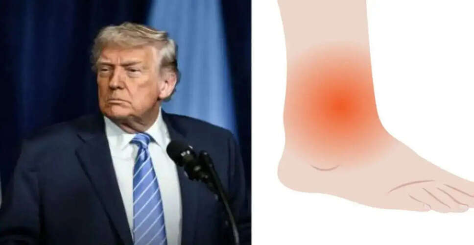 Concerns Arise Over Donald Trump's Health After Recent Appearance