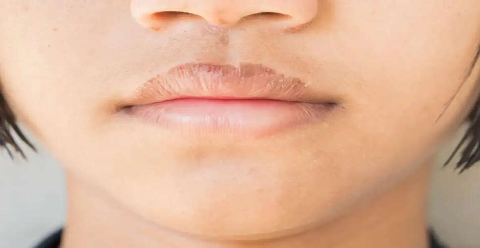 DIY Natural Lip Scrub for Soft and Healthy Lips This Winter