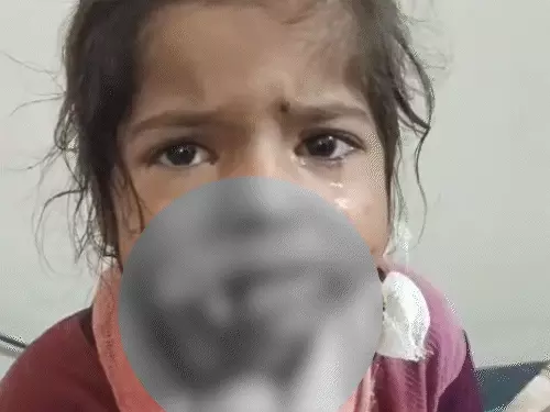 Tragic Dog Attack in Rajasthan Leaves Child Injured