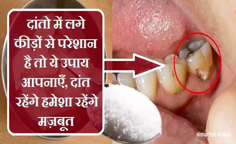Effective Remedies for Tooth Decay and Prevention Tips