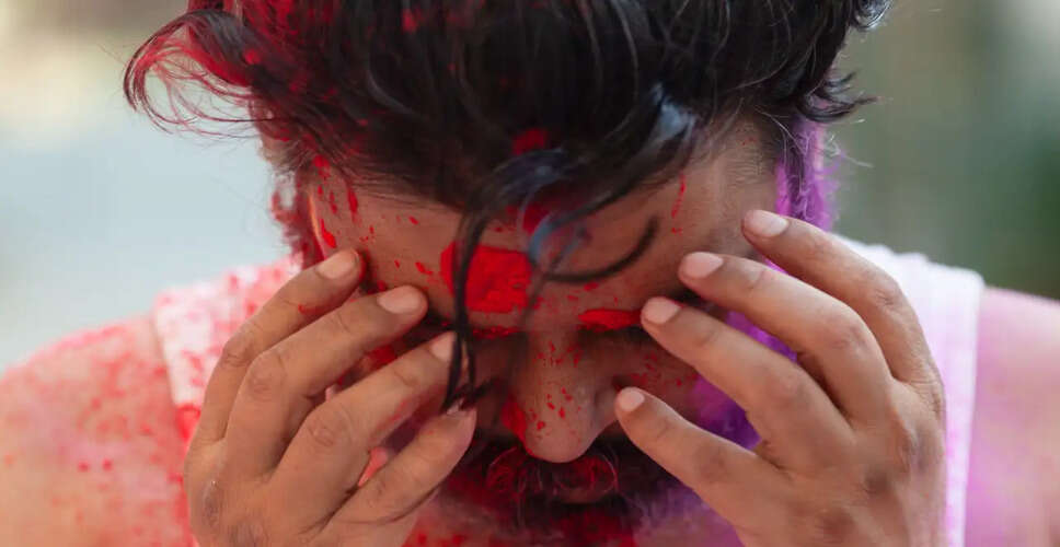 Understanding and Preventing Post-Holi Migraines