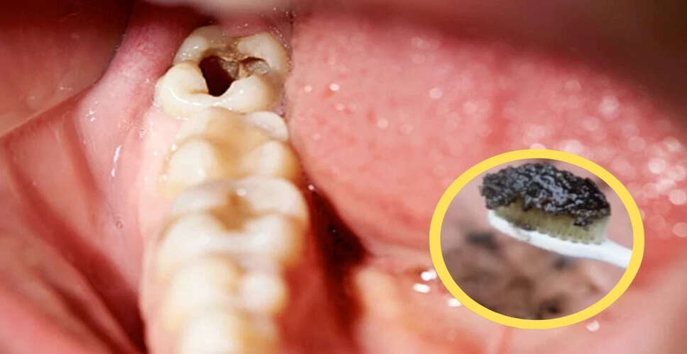 Homemade Toothpaste: A Natural Solution for Cavities