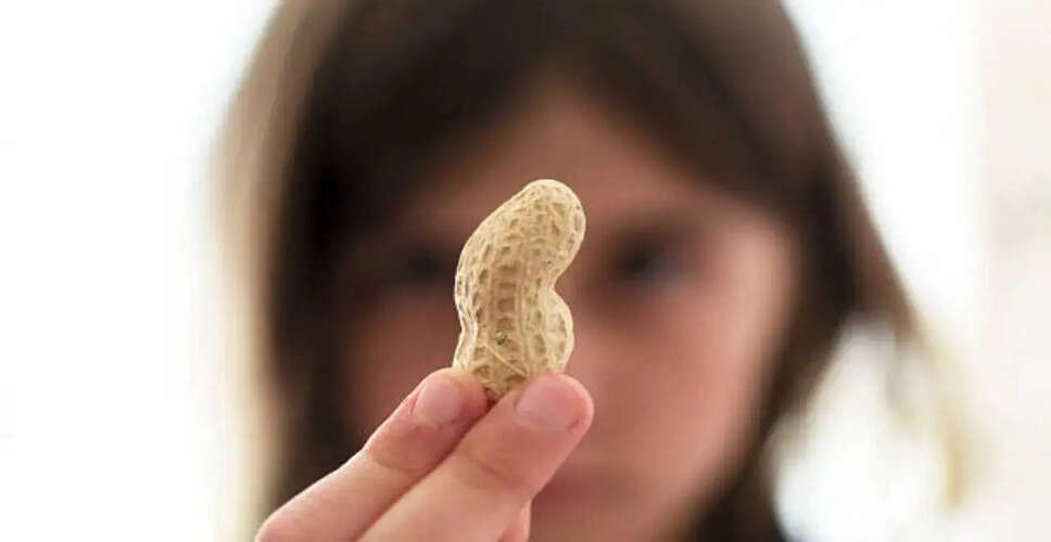 New Study Offers Hope for Managing Childhood Peanut Allergies