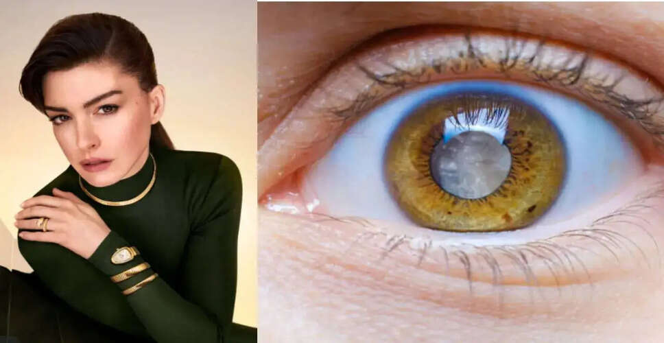 Anne Hathaway Opens Up About Her Journey with Vision Loss and Cataract Surgery
