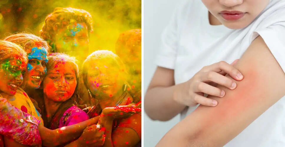 Essential Tips for Protecting Sensitive Skin During Holi Celebrations