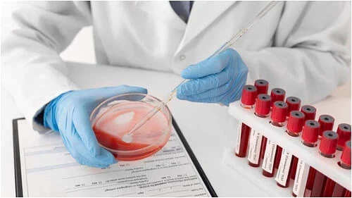 Essential Health Checkups for Men Over 40