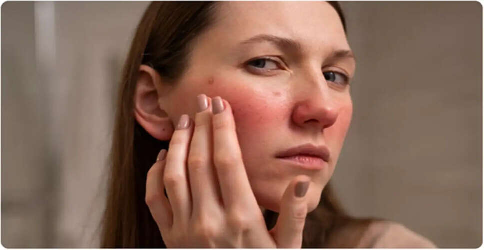 The Refreshing Benefits of Ice Facials for Summer Skin Care