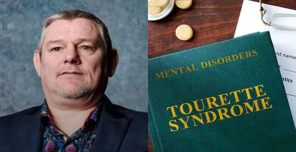 Raising Awareness: John Davidson's Moment at the BAFTA Awards Highlights Tourette Syndrome