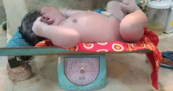 Astonishing Birth: Assam Woman Welcomes 5.2 kg Baby