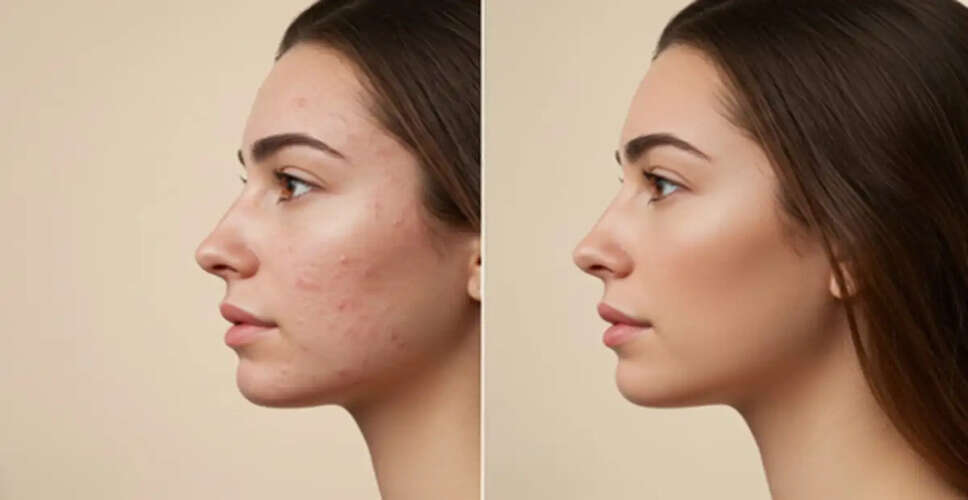Natural Remedies for Glowing Skin This Summer
