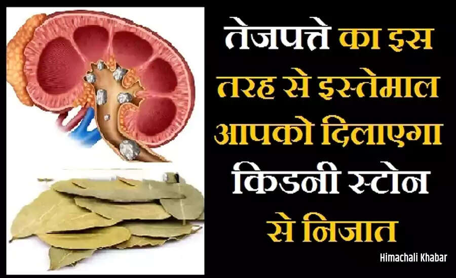 The Health Benefits of Bay Leaves You Should Know