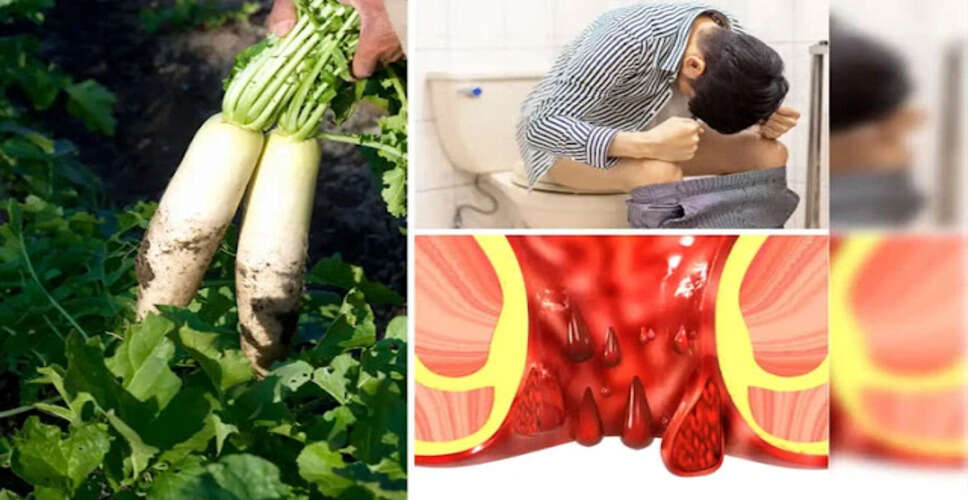 Understanding Hemorrhoids: Causes, Symptoms, and Effective Remedies