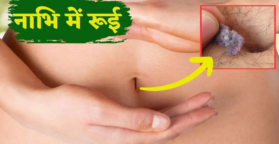 Understanding Navel Fluff: Causes and Care