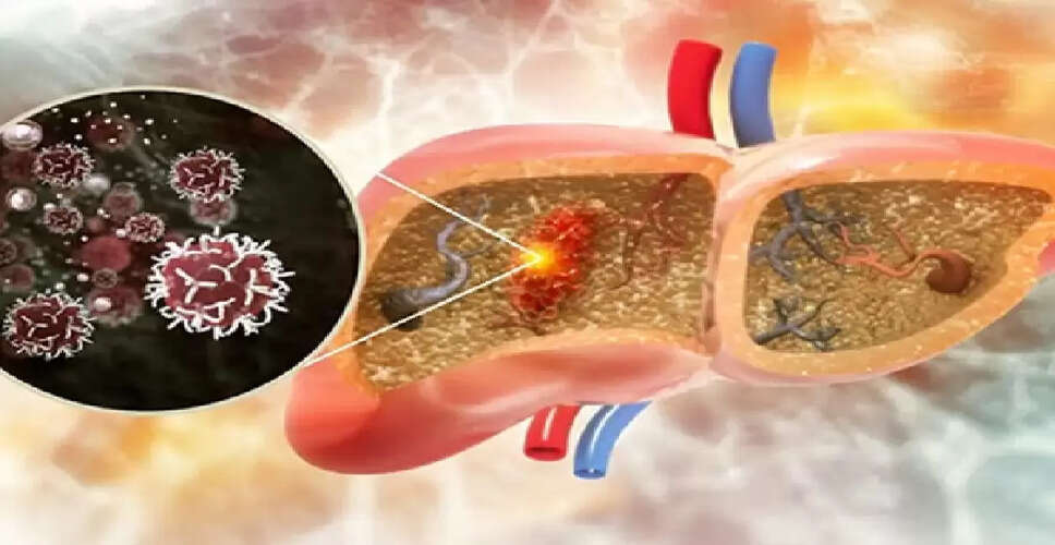 Understanding the Warning Signs of Liver Cancer