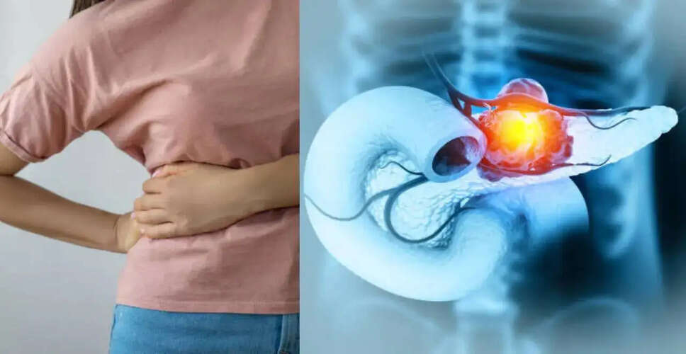 New Pill Offers Hope for Advanced Pancreatic Cancer Patients
