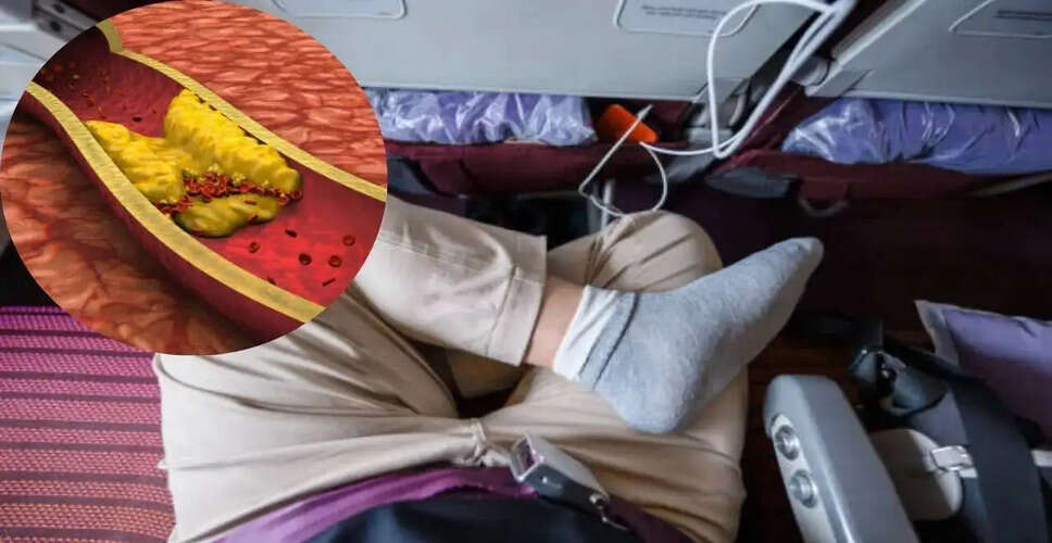 Understanding the Risks of Sitting Cross-Legged During Flights