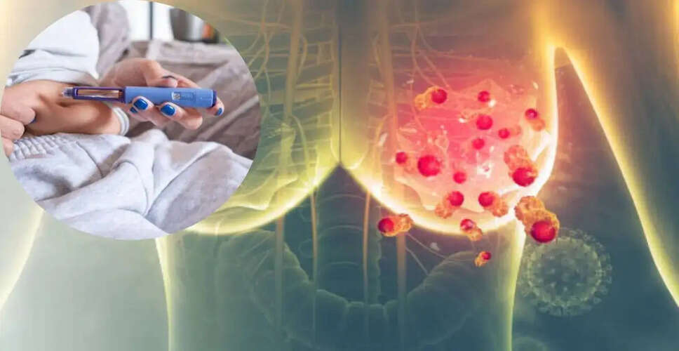 New Study Links GLP-1 Medications to Reduced Breast Cancer Risk