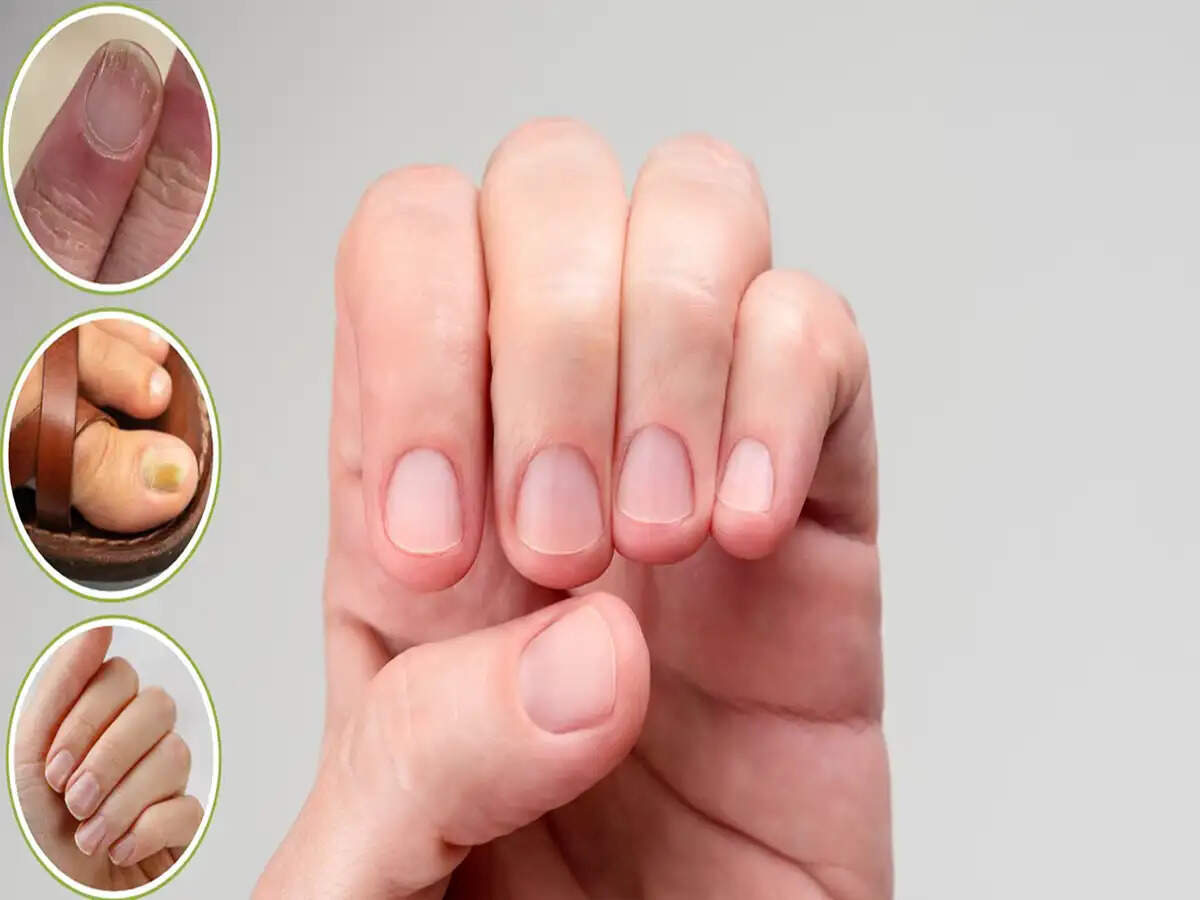 Understanding Nail Health: What Your Fingernails Reveal About Your Well-Being