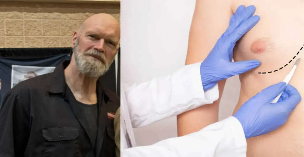 Tyler Mane's Battle with Male Breast Cancer: Raising Awareness and Encouraging Early Detection