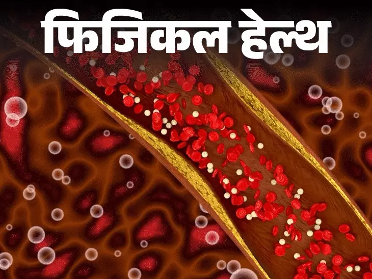 New Cholesterol Guidelines Stress Early Testing for Heart Health