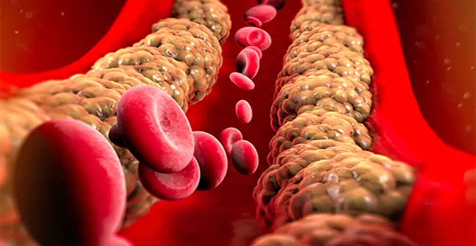 Understanding Cholesterol: Tips for a Healthier Lifestyle
