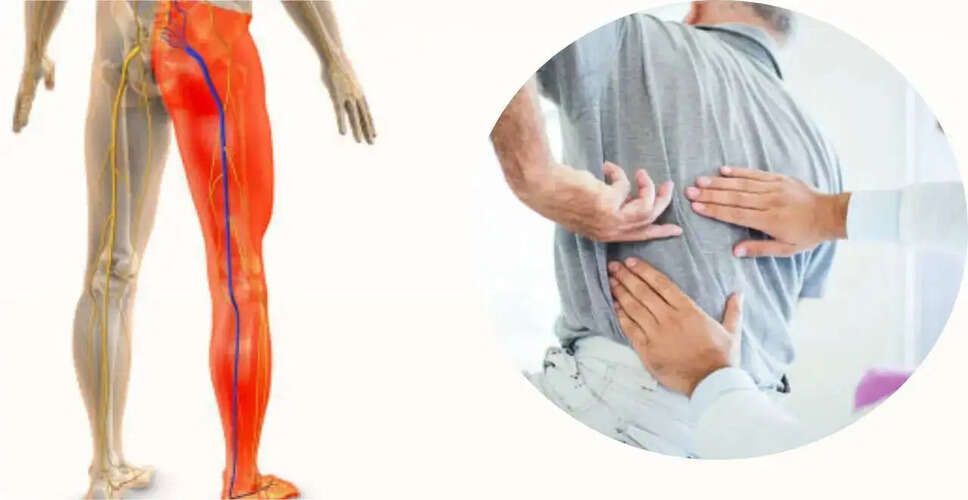 Understanding Sciatica: Causes, Symptoms, and Treatment Options
