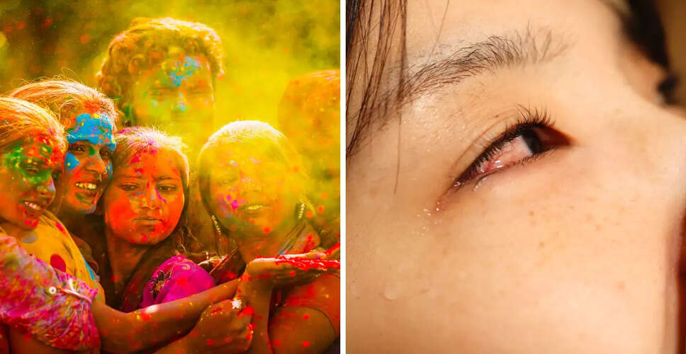 Essential Eye Care Tips for Holi: What to Do If Colors Get in Your Eyes