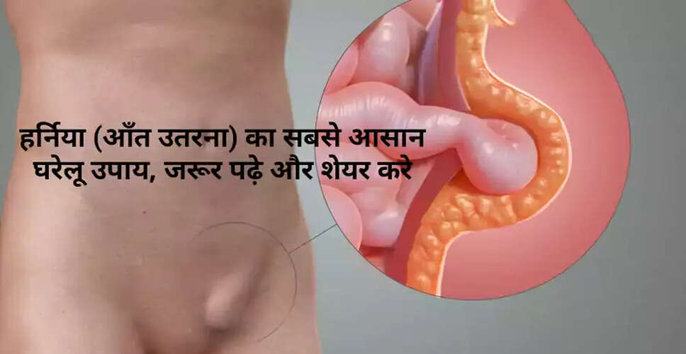 Understanding Hernia: Causes, Symptoms, and Treatment Options