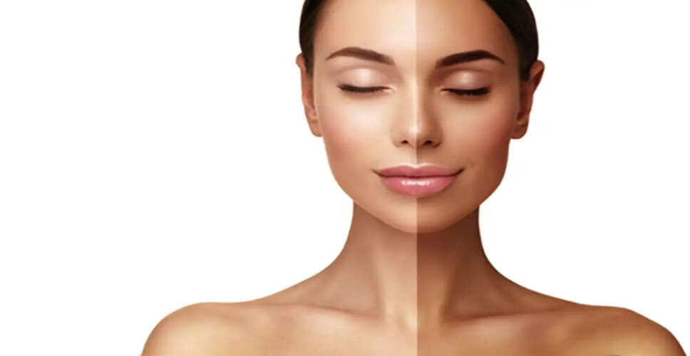 Effective Home Remedies to Combat Sun Tanning