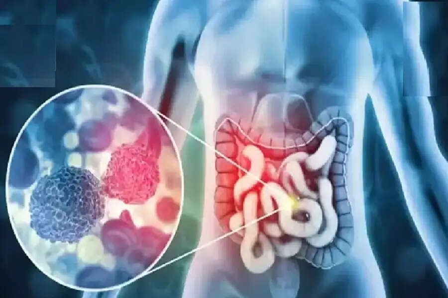 Understanding Early Signs of Cancer: What to Watch For