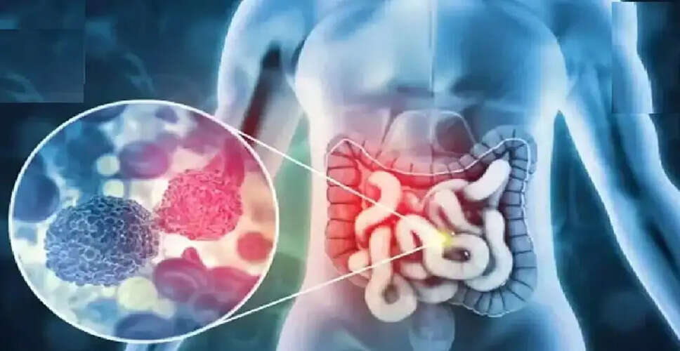 Understanding Early Signs of Cancer: What to Watch For