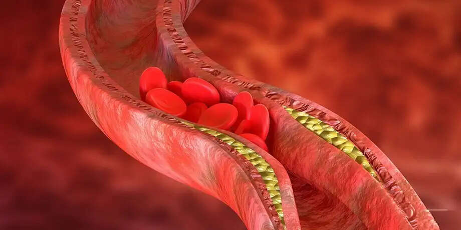Effective Ways to Lower Cholesterol Levels Naturally