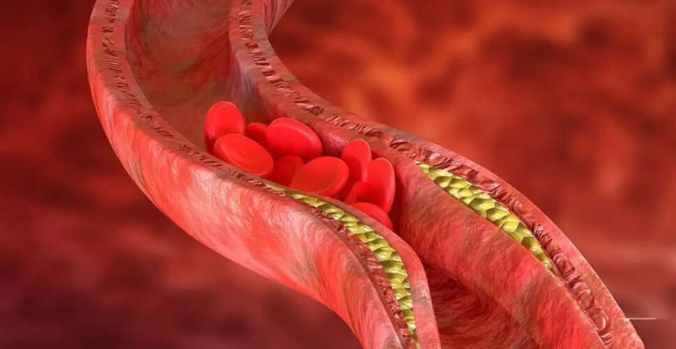 Effective Ways to Lower Cholesterol Levels Naturally