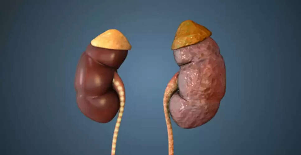 Recognizing the Early Signs of Kidney Failure: A Vital Guide