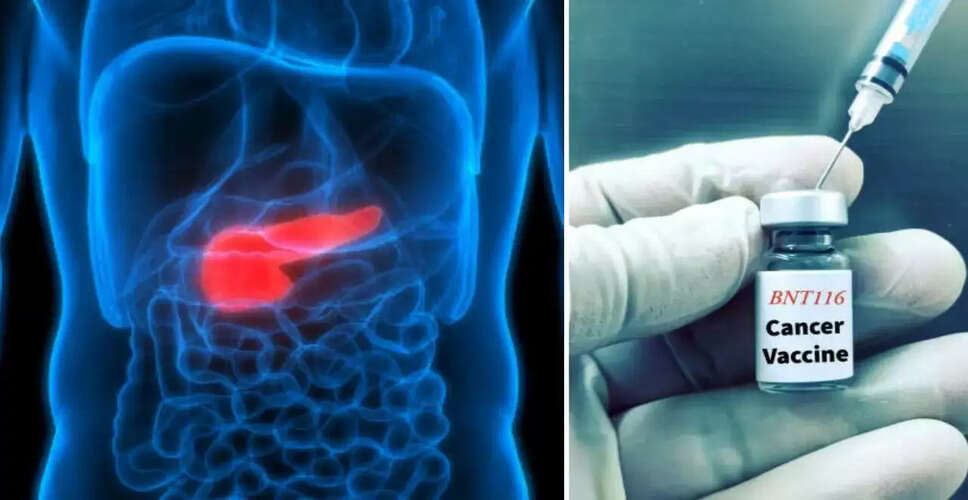 Innovative mRNA Vaccine Offers New Hope for Pancreatic Cancer Patients