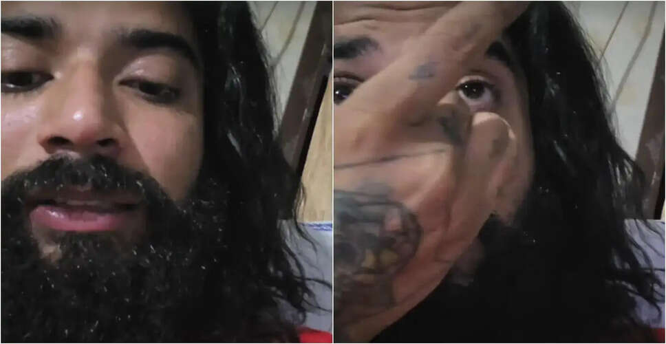 Anurag Dobhal's Journey of Recovery After Suicide Attempt