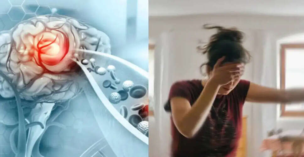 Rising Stroke Cases Among Young Adults in India: Key Findings and Prevention Strategies