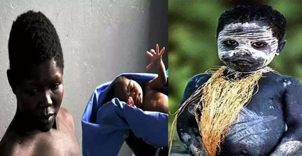 The Jarawa Tribe: A Unique Perspective on Skin Color in India