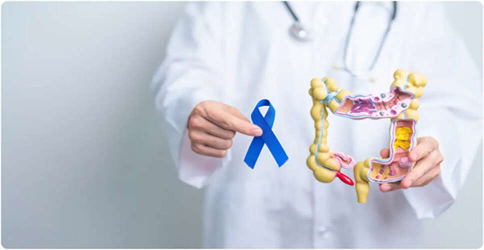 Understanding the Role of Soluble Fiber in Managing IBS Symptoms