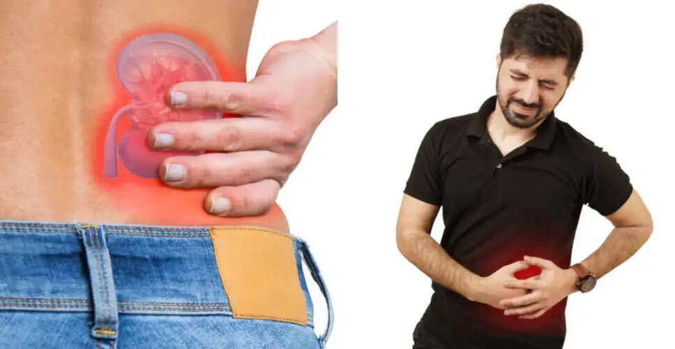 Understanding Kidney Stones: Causes, Risks, and Prevention Strategies