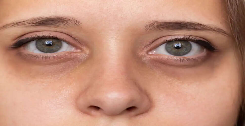 Unlock Radiant Skin with Potato Juice: A Natural Remedy