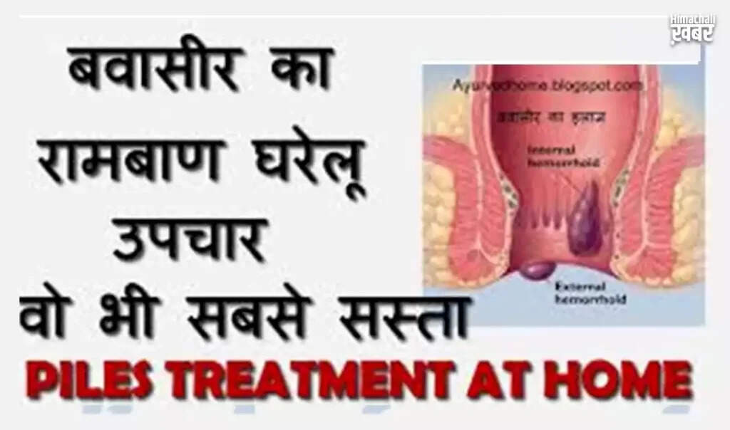 Health Benefits of Cauliflower: A Nutritional Powerhouse