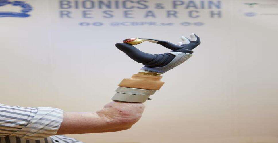Bionic hand, merged with woman's nervous & skeletal systems, functional after years