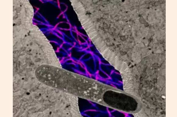 Discover the Gut Bacterium That Could Revolutionize Weight Loss!