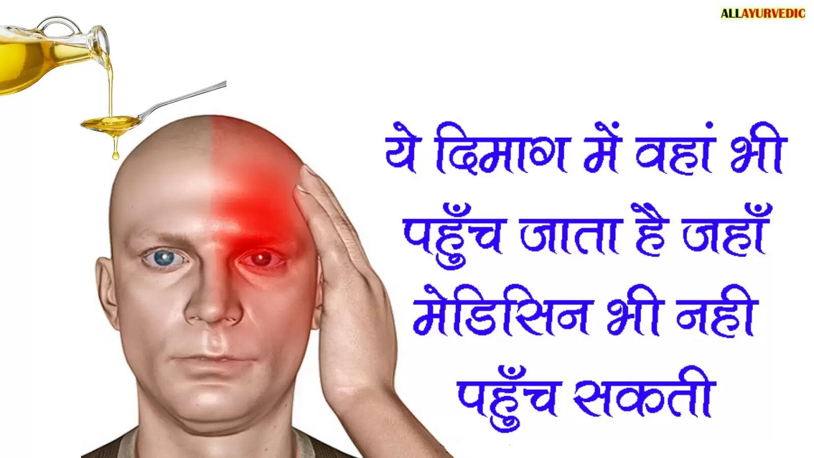 Effective Home Remedies for Migraine Relief